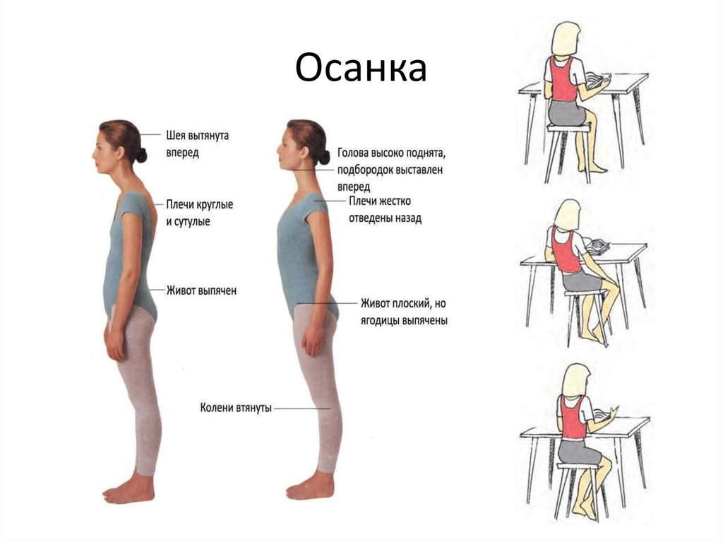 Признаки правильной осанки