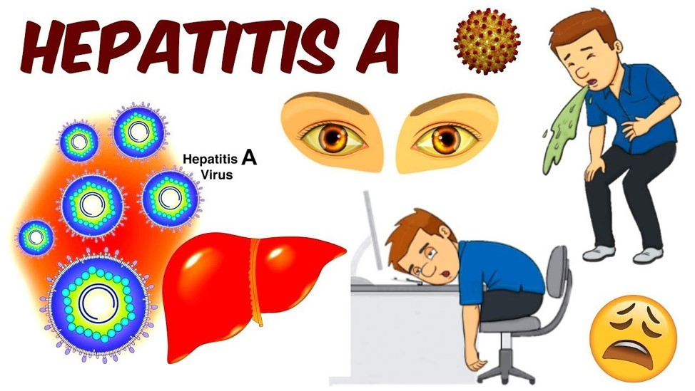 Вирусный гепатит А